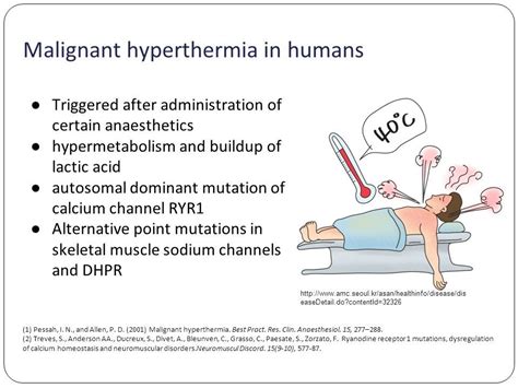 diagnosis of malignant hyperthermia